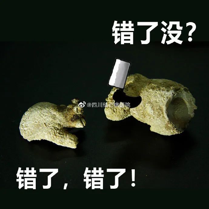 胆结石拖一拖无所谓？四川保胆取石专家：那是你没见识到它的“杀伤力”(图6)