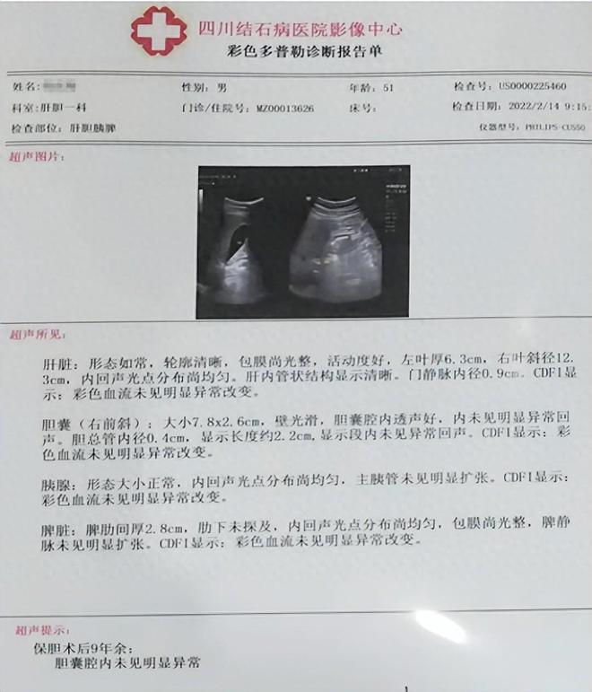 成都保胆医院对话保胆者：华阳患者保胆9年，用亲历讲述术后生活(图1)