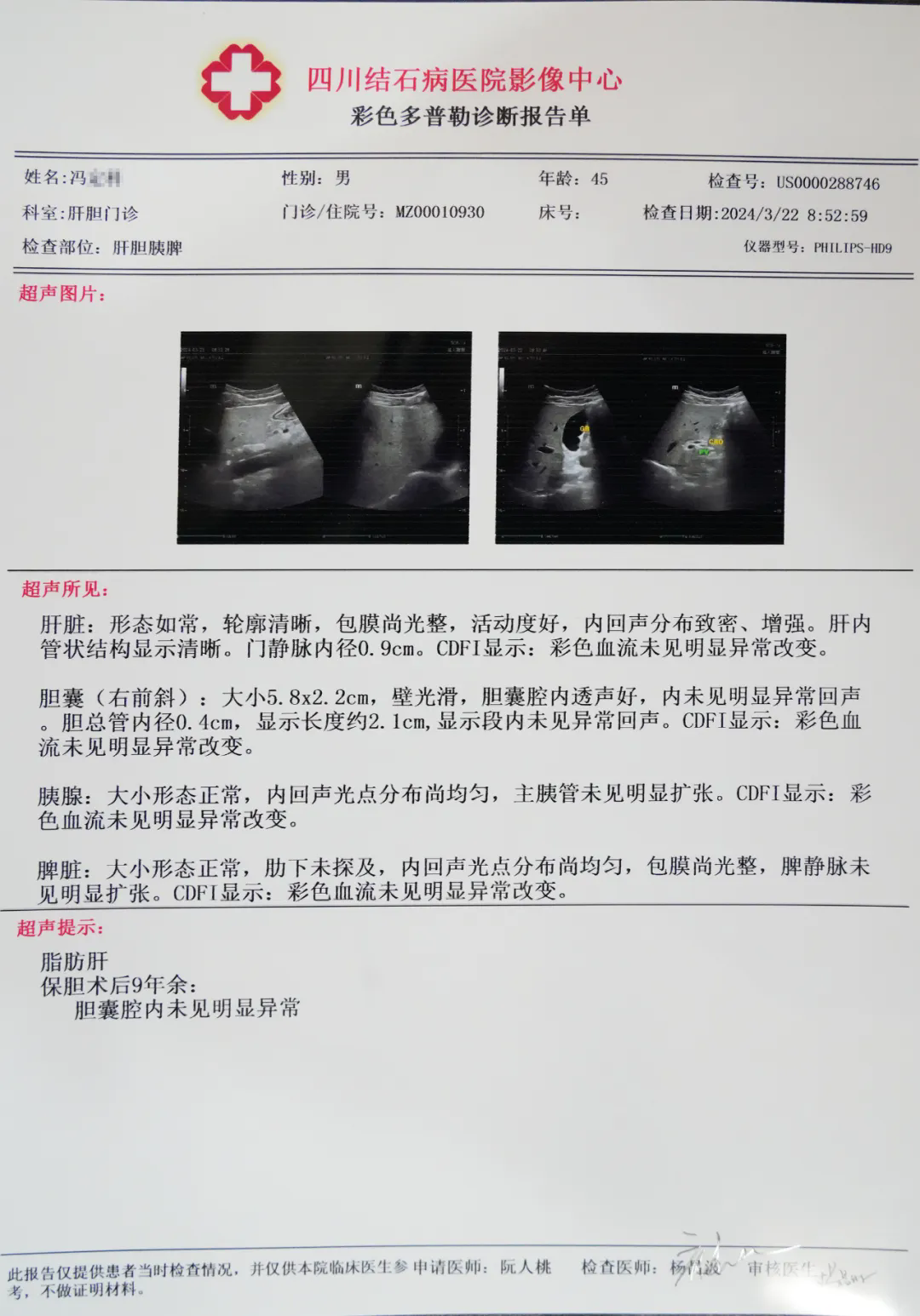 四川保胆取石9年多,他说:医生的技术水平好,术后一切正常!(图1) 四川保胆取石9年多,他说:医生的技术水平好,术后一切正常!(图1)