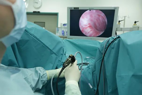 四川瑞梦热蒸汽消融术:前列腺增生治疗新技术!(图3) 四川瑞梦热蒸汽消融术:前列腺增生治疗新技术!(图3)