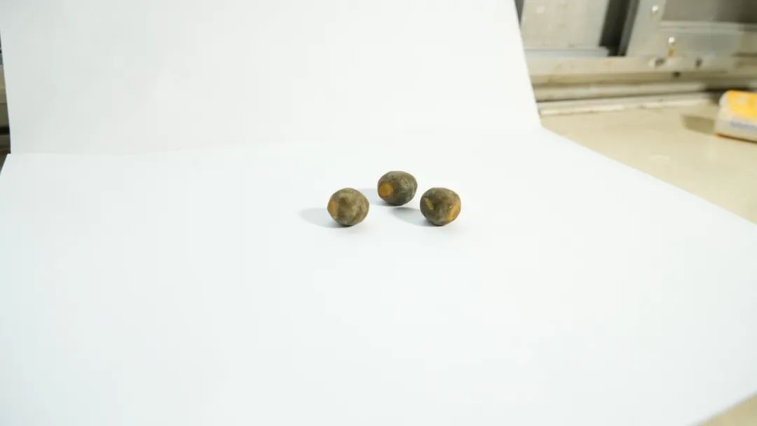 四川保胆案例:巴中姐妹同患胆结石,先后来蓉圆梦“保胆”(图3) 四川保胆案例:巴中姐妹同患胆结石,先后来蓉圆梦“保胆”(图3)