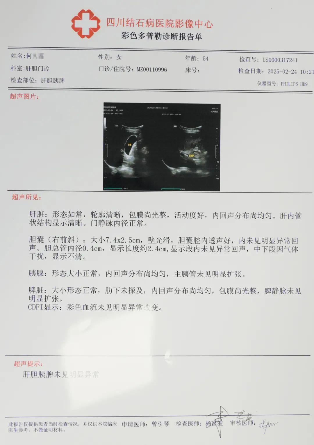 【成都肝胆结石最好的医院】她亲身分享保胆12年来跟没手术一样!(图2) 【成都肝胆结石最好的医院】她亲身分享保胆12年来跟没手术一样!(图2)