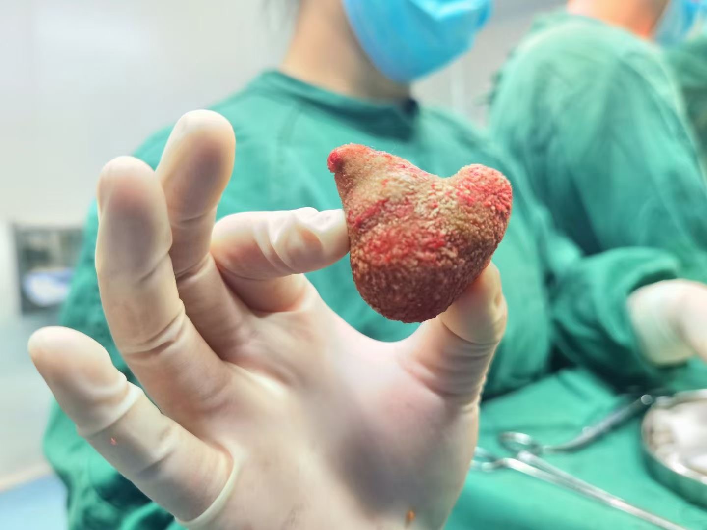 患者关注:肾结石手术痛苦吗?泌尿外科专家为你揭秘真相【成都结石病医院 | 成都肾结石医院】(图2) 患者关注:肾结石手术痛苦吗?泌尿外科专家为你揭秘真相【成都结石病医院 | 成都肾结石医院】(图2)