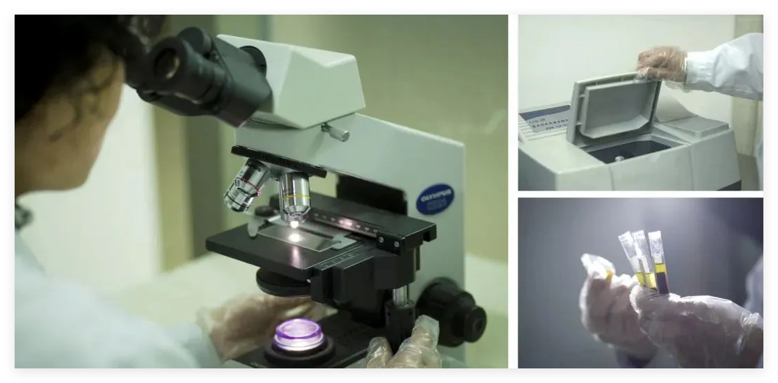 建议收藏！肾结石患者最关心的8大问题，一次性讲清楚！【四川肾结石专科医院】(图6)