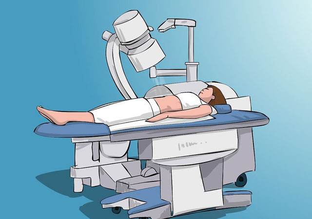 体外冲击波碎石对肾脏有多大损伤?一文读懂治疗风险与应对方案!【成都24小时碎石医院】(图2) 体外冲击波碎石对肾脏有多大损伤?一文读懂治疗风险与应对方案!【成都24小时碎石医院】(图2)