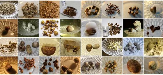 发现胆结石，为什么建议要尽早处理？何明刚主任详解四大核心原因！【四川胆结石专科医院】(图2)