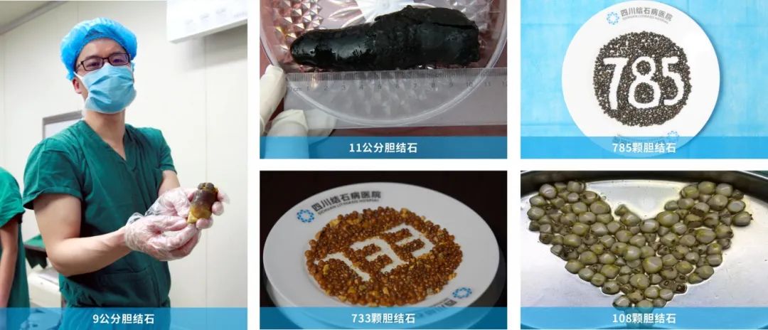 喜报!患者心目中的“保胆卫士”,我院陈红春主任荣膺卫健局“优秀医师(图4) 喜报!患者心目中的“保胆卫士”,我院陈红春主任荣膺卫健局“优秀医师(图4)