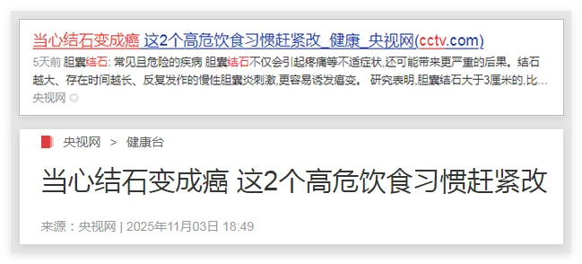 警惕！结石长期不重视可能癌变，这2个高危饮食习惯赶紧改【四川胆结石专科医院】(图1)