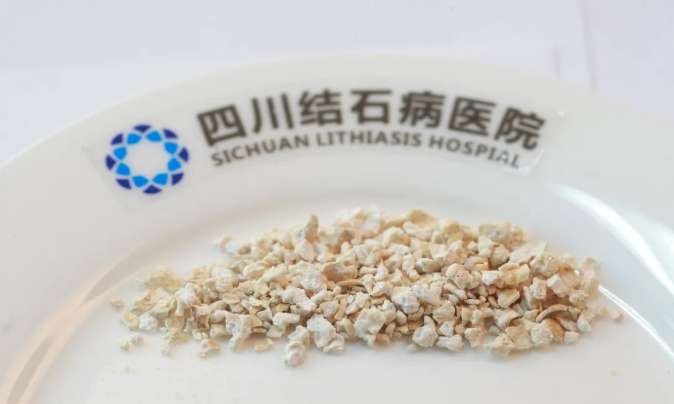 节前必看护肾指南 | 春节聚餐欢乐多，小心结石突然 “发难”！(图5)