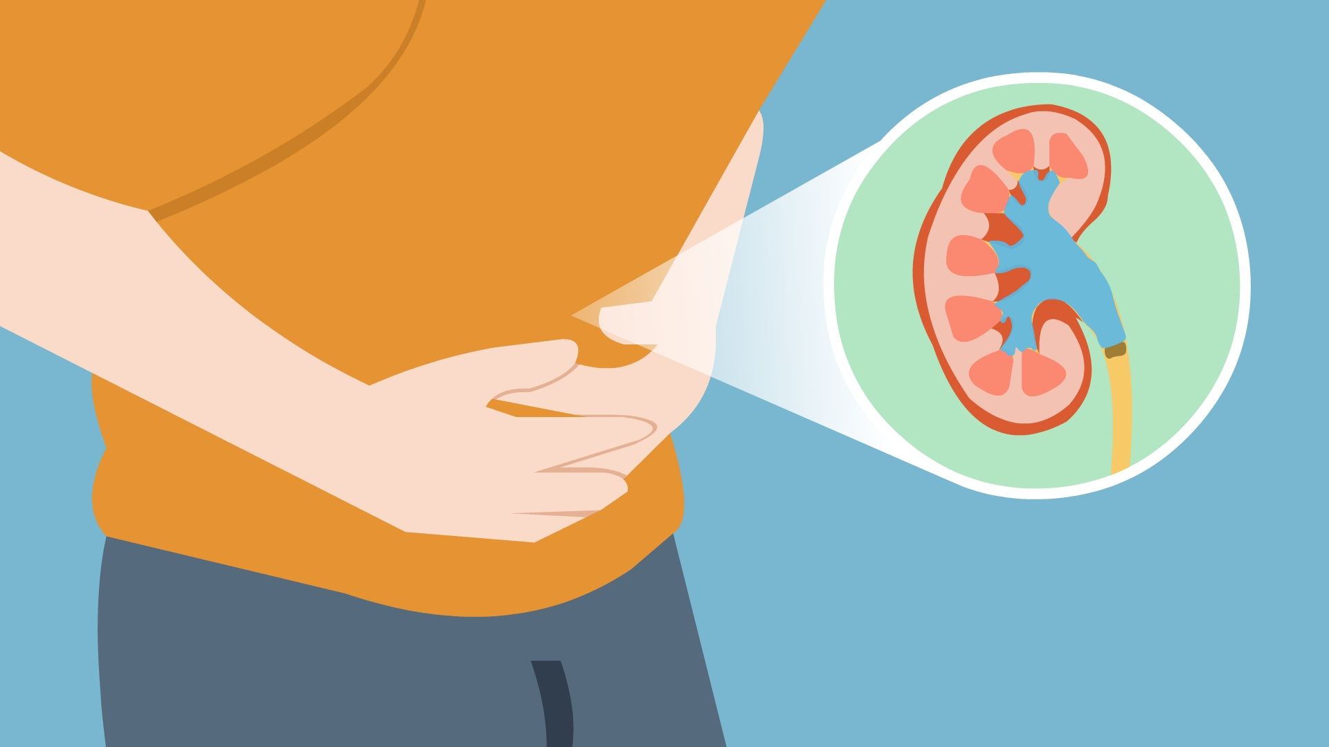 引起肾结石的主要原因是什么？一定要注意这几个习惯！【四川结石病医院】(图2)